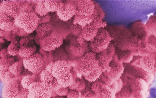Bio-inspired urchin-like metal Bio-inspired urchin-like metal microscopy zoom background