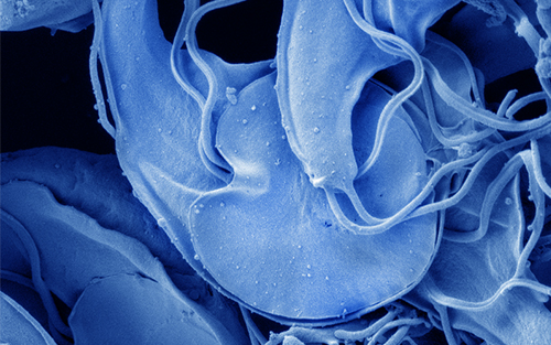Giardia duodenalis trophozoites Giardia duodenalis trophozoites microscopy zoom background